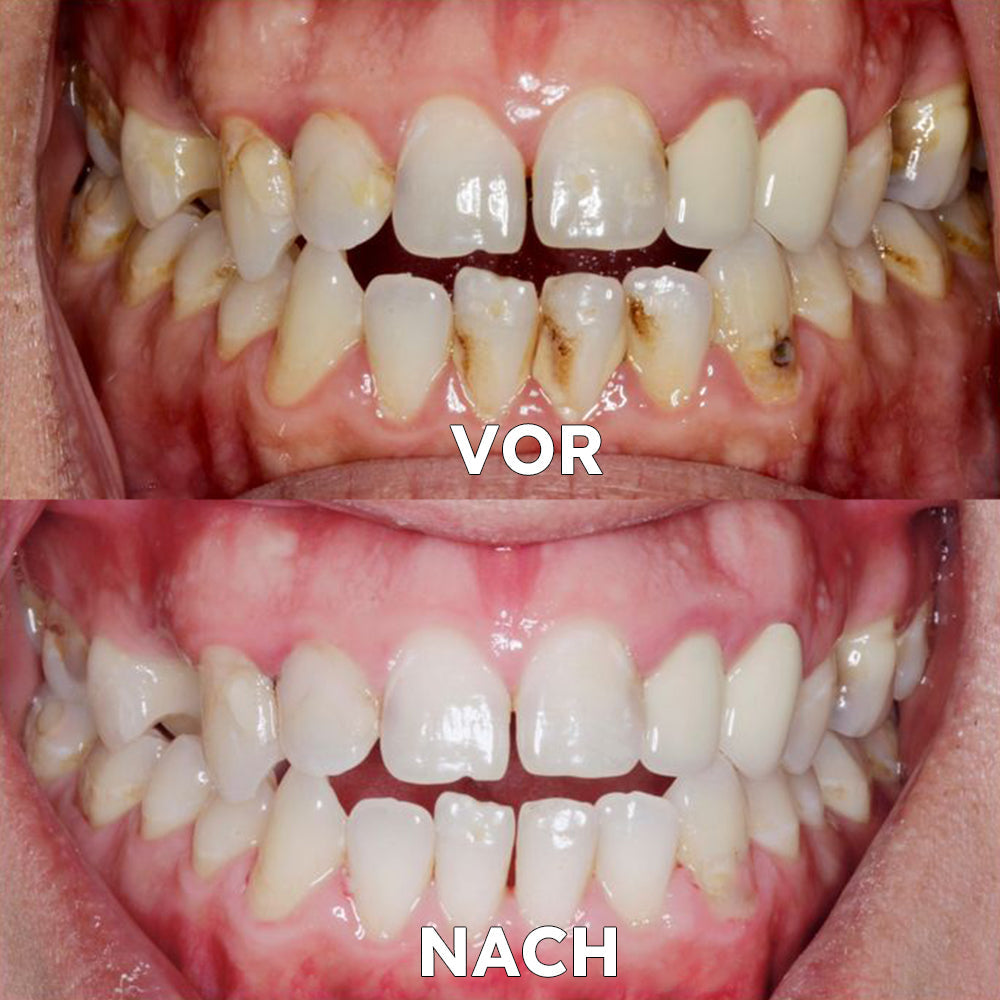FrischeAura – Kokosöl-Mundspülung für frischen Atem & gesundes Zahnfleisch