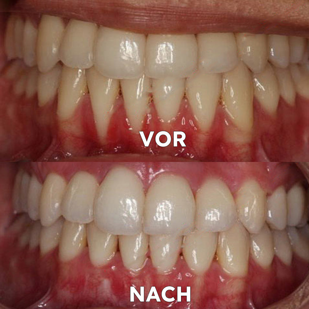 FrischeAura – Kokosöl-Mundspülung für frischen Atem & gesundes Zahnfleisch